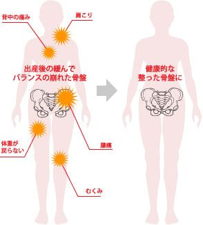 産後の骨盤矯正 整体は港区浜松町ハプティカイロプラクティック 産後の骨盤矯正 整体は港区浜松町ハプティカイロプラクティック